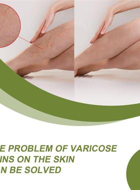 My legs are creamed, my legs are discomforted, my legs are s