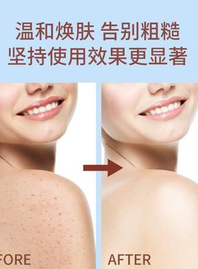 ESTELINs skin is soaking the bodys butter, its so fine, i