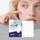 Facial Breathable Acne Skin JAYSUING and Patches Friendly