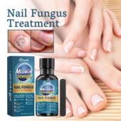Nail for Repair Ximonth Liquid designed embedded thickened