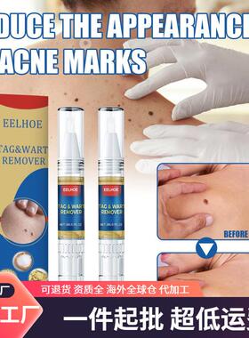 EELHOE Skin Tag and Mole Remover Pen - Body Skin Tag and War