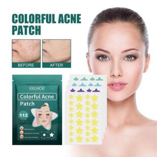 EELHOE Star-Shaped Acne Patches - Gentle Cleansing, Fading,