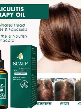 EELHOE Scalp Nourishing Hair Oil - Deep Cleansing and Repair