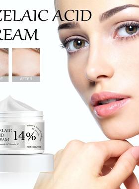 WIYUN Acne Treatment Cream - Deep Cleansing and Moisturizing