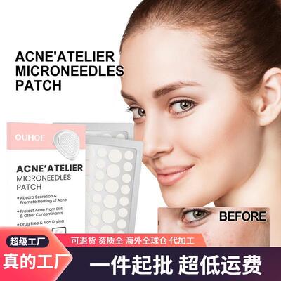 OUHOE Acne Patches - Redness Repair, Acne and Pimple Treatme
