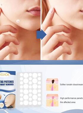eelhoe 克尤贴片 温和清洁护理皮肤，适用于脸部和脖子，修复并使