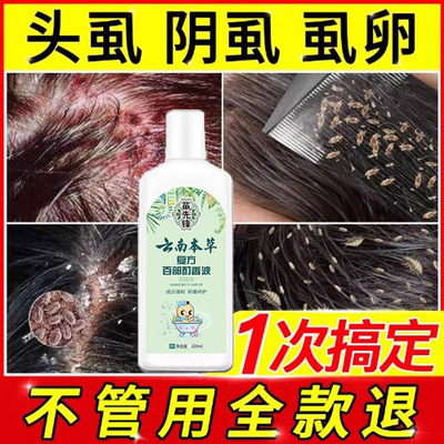 虱子药小女孩头发去除虱卵除儿童小孩头上去虱子的洗发水虫卵双杀