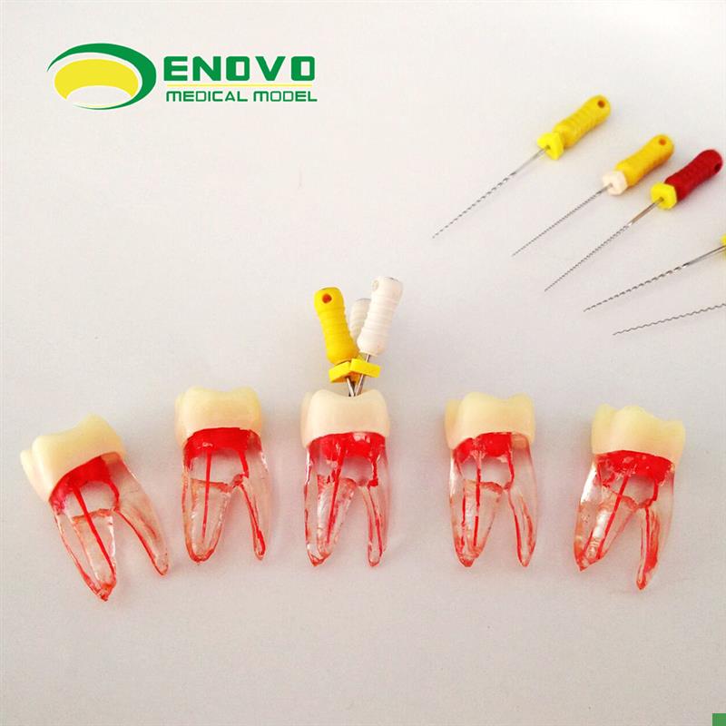 ENOVO正品根管仿真离体RCT根管教学练习牙体S牙髓根管器械操作