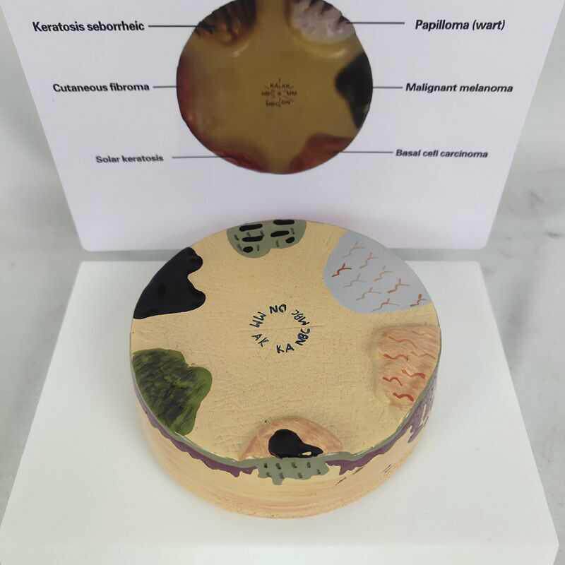 人体皮肤解剖模型病理t皮肤演示皮肤科教具多症状皮肤病演示