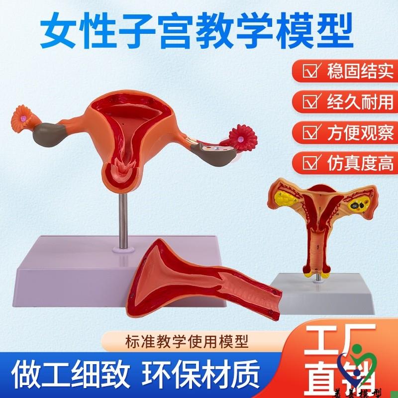 子宫模型生殖器解剖模型计划y生育示教模型妇科解剖教学医学模型