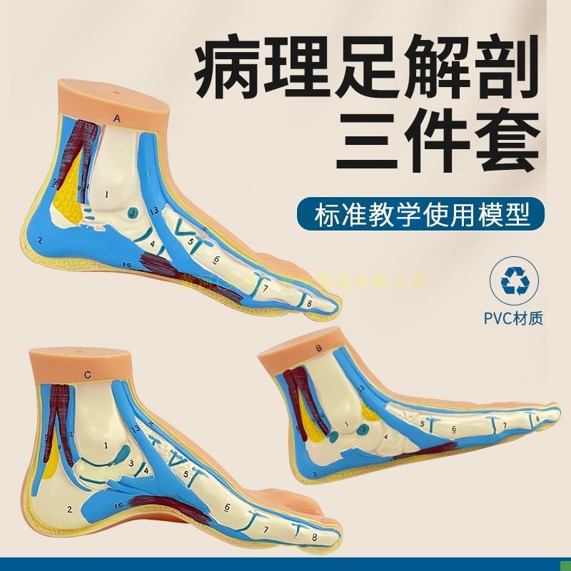 脚模型正常足扁h平足弓型足解剖模型脚部构结构造肌肉血管教学医