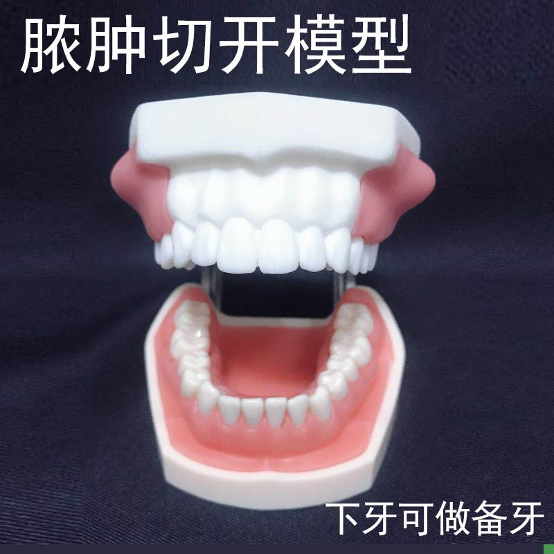 脓肿切开模型口腔执业医师考前z培训引流牙模牙科教学牙齿肿块可