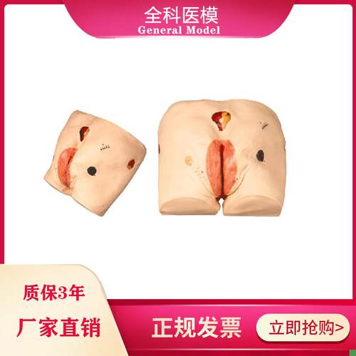 高级压疮(褥疮)m护理模型操作练习训练医学教学臀部模型