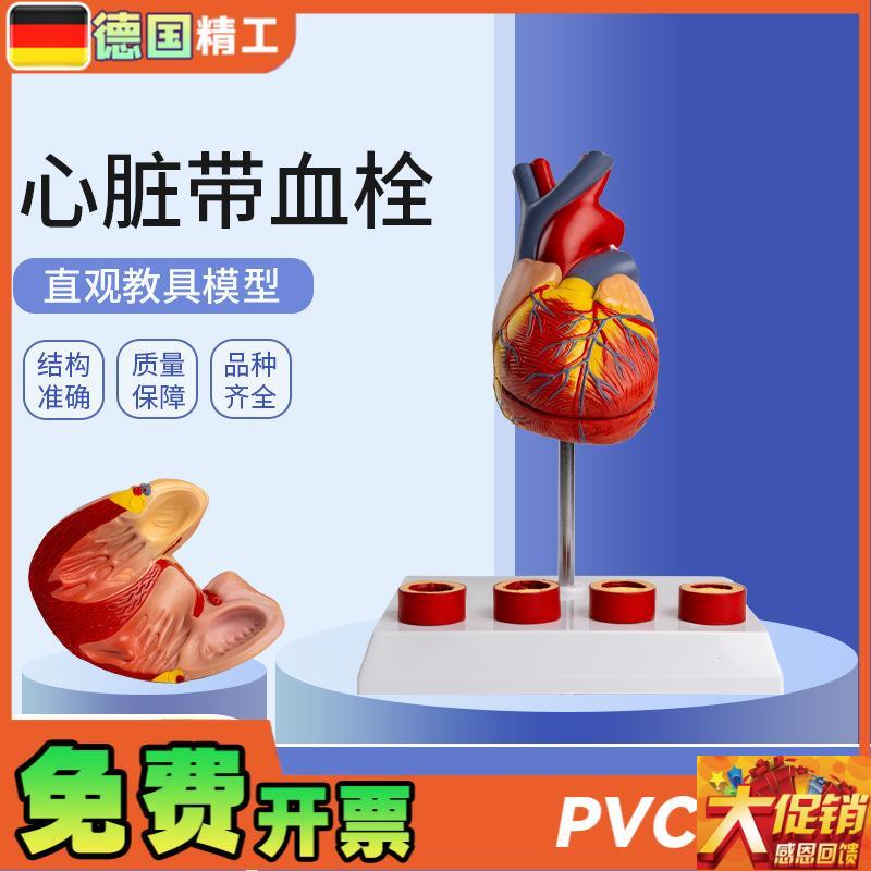 德国】心脏带血栓模型 解剖可拆卸教I学仿真 自然大心脏带血栓血