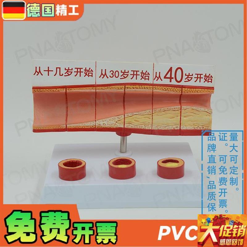 德国】人体动脉血管n堵塞模型心脑血管血栓/硬化模型 教学心脑血