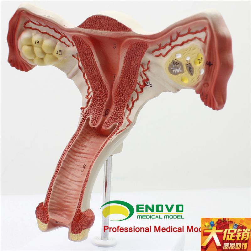 颐诺正品人体医用女性子宫模型卵巢生殖L结构解剖模型妇科妇产科