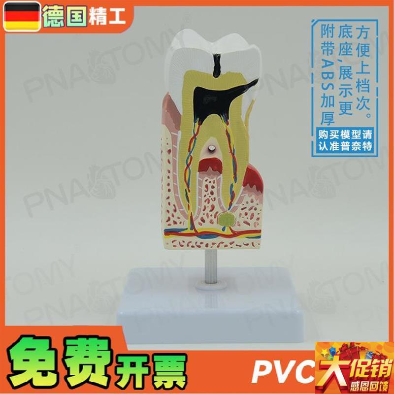 德国】人体牙齿模型蛀牙龋齿解剖口腔科H牙科 教学牙神经医患沟通