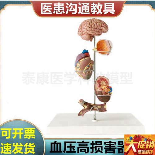 心脑血管模型血液l压力升高病理脏器受损糖尿眼底肾脏冠状动脉阻