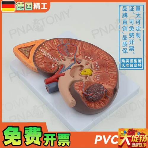 德国】人体肾脏h内脏结构肾上腺解剖放大模型泌尿生殖系统 男科泌