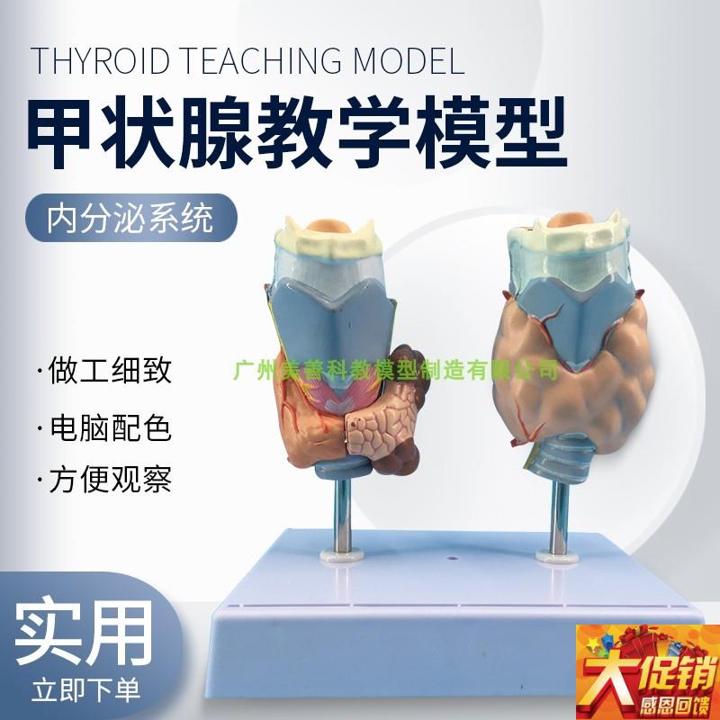 病理甲状腺模型 喉头解剖模型 甲状腺留 甲状线囊X中 甲状线病
