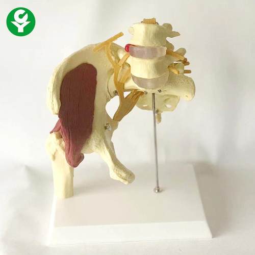 成人腰椎带肌肉模型盆骨腰间盘A突出产妇盆底肌修复演示骶骨神经