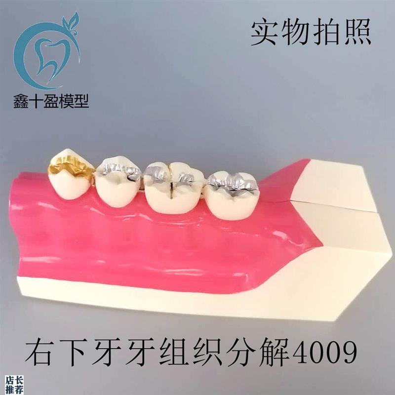 牙齿模型右下后牙组织分解模型教学演示模型牙.科模型M9