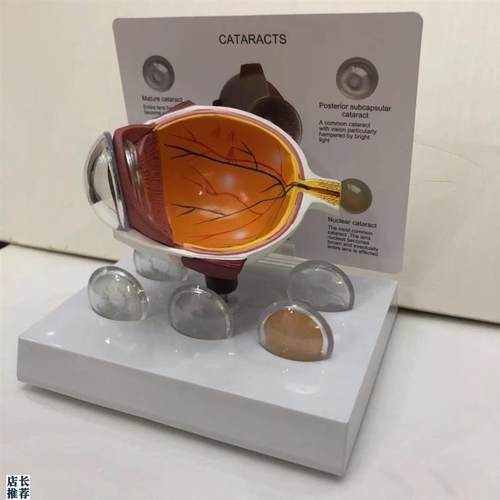康泰医学模型眼球视网膜眼底血管青光眼白内障角膜V病变视力晶状