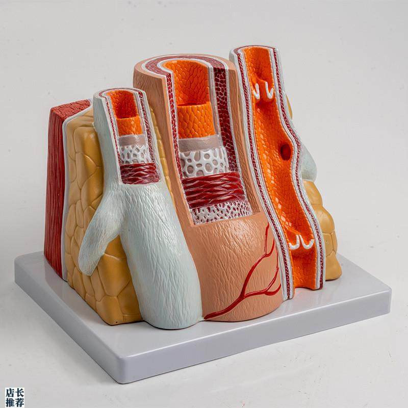 人体血管模型动脉管结构静脉瓣血液循环系统冠状粥样X脂肪沉积阻