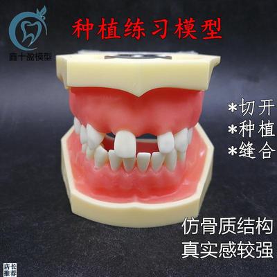 牙科种植b上下缺失练习切开种植缝合仿骨质牙齿模型上颌窦提升术