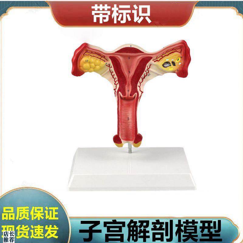 子宫解剖模型女生殖器解剖u可拆卸盆底肌肛周肌肉泌尿道膀胱妇科