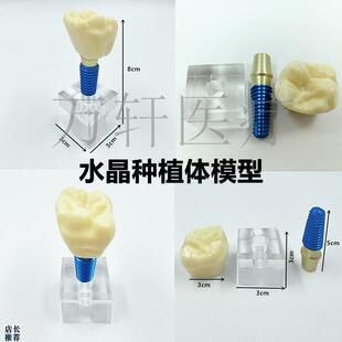 牙科口腔种植体模型水晶种植体牙模可拆K卸口腔教学模型齿科小水