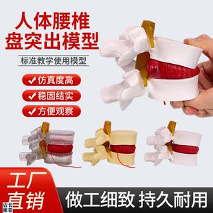 仿真腰椎模型椎间盘1:1人体骨骼脊柱K脊椎解剖医用教学骨架标本