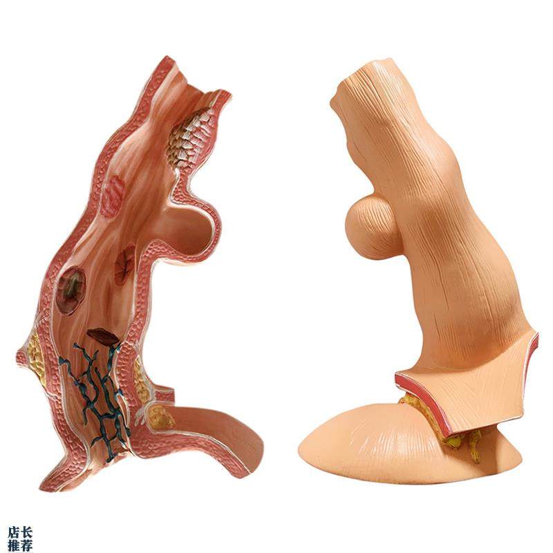 人体食管食道胃部消化系统解剖模型解G剖骨骼教学医学教具厂家包