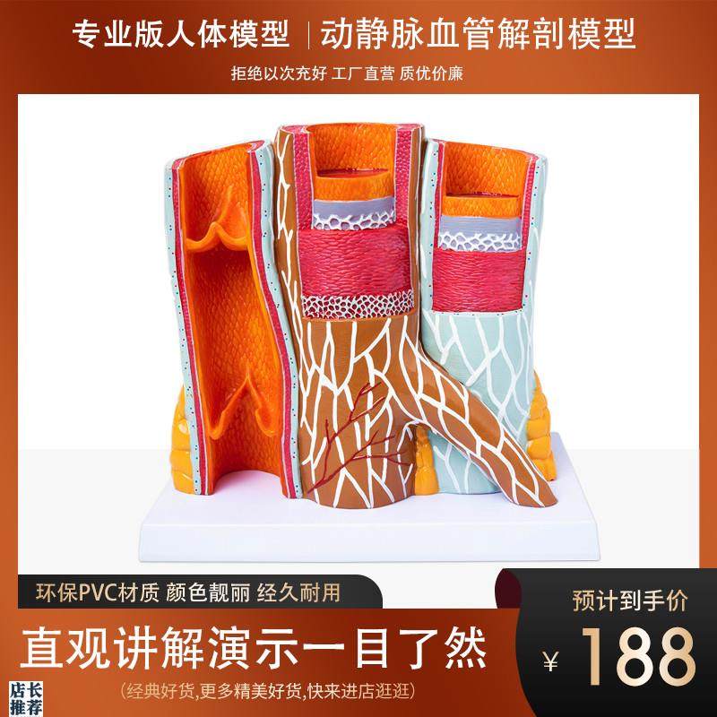 政河人体动静脉血管模型器官解剖放大层次结Q构演示教学医院学校