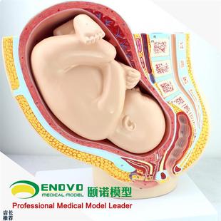ENOVO颐诺人体女性妊娠足月胎儿盆腔系K统模型怀孕生殖系统子宫妇