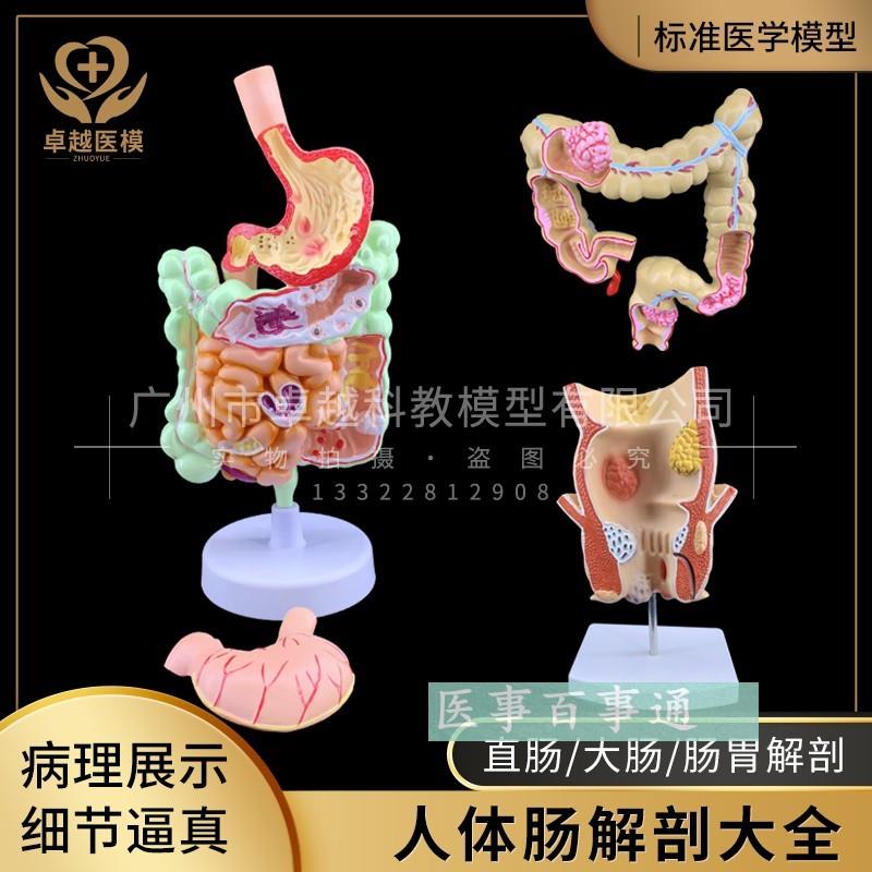 人体大肠病理模型肠胃解剖模型大肠盲肠Q直肠十二指肠模型