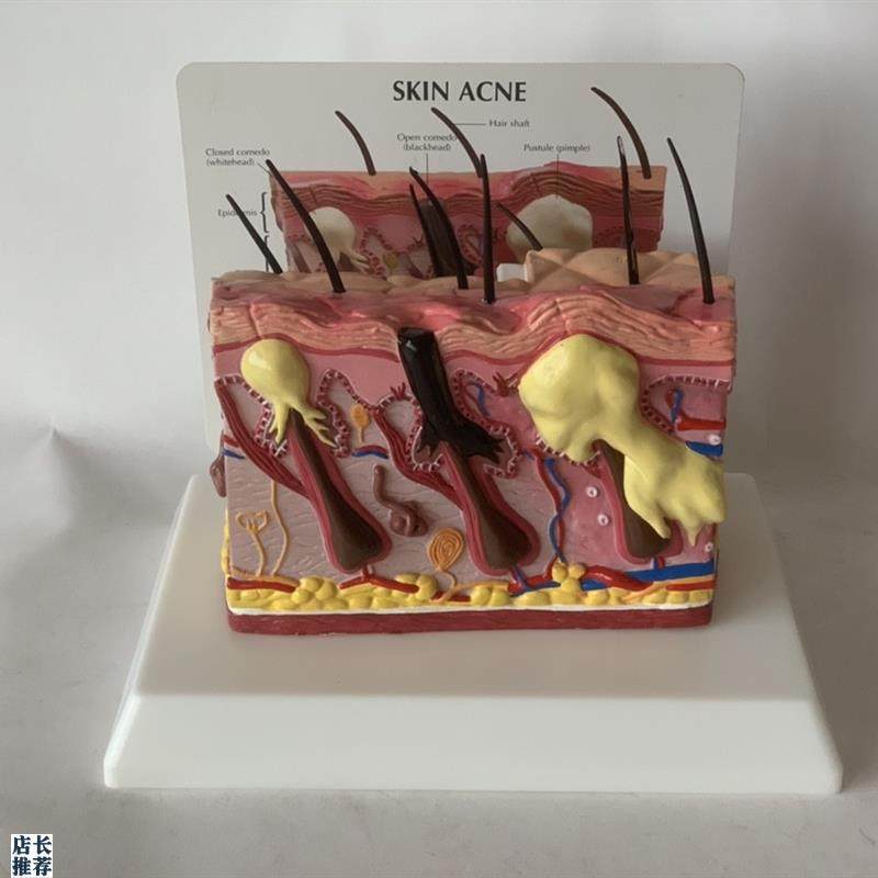 人体皮肤放大皮肤k痤疮毛发生长头发健康皮肤脱发毛囊毛细血管黑