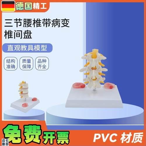 德国】PNT0131三节腰椎带病变椎间盘病变椎间盘骨骼X模型骨科疼痛