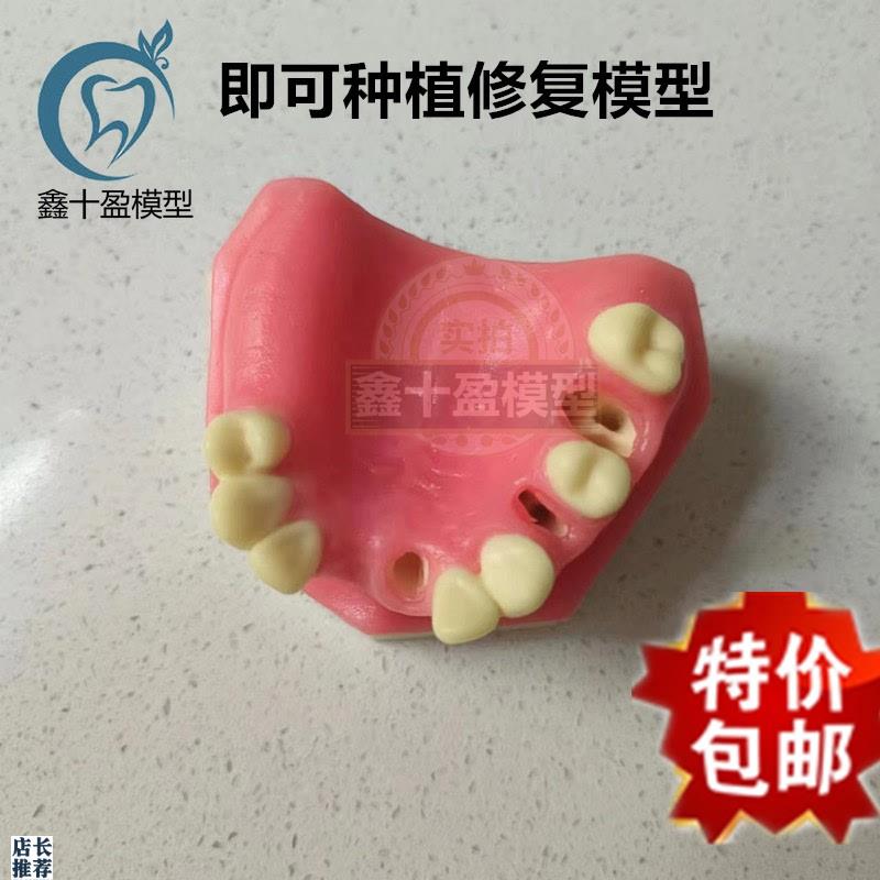 口腔种植练习模g型上颌骨上颌窦牙列缺失种植体齿科牙齿模型PIM-2