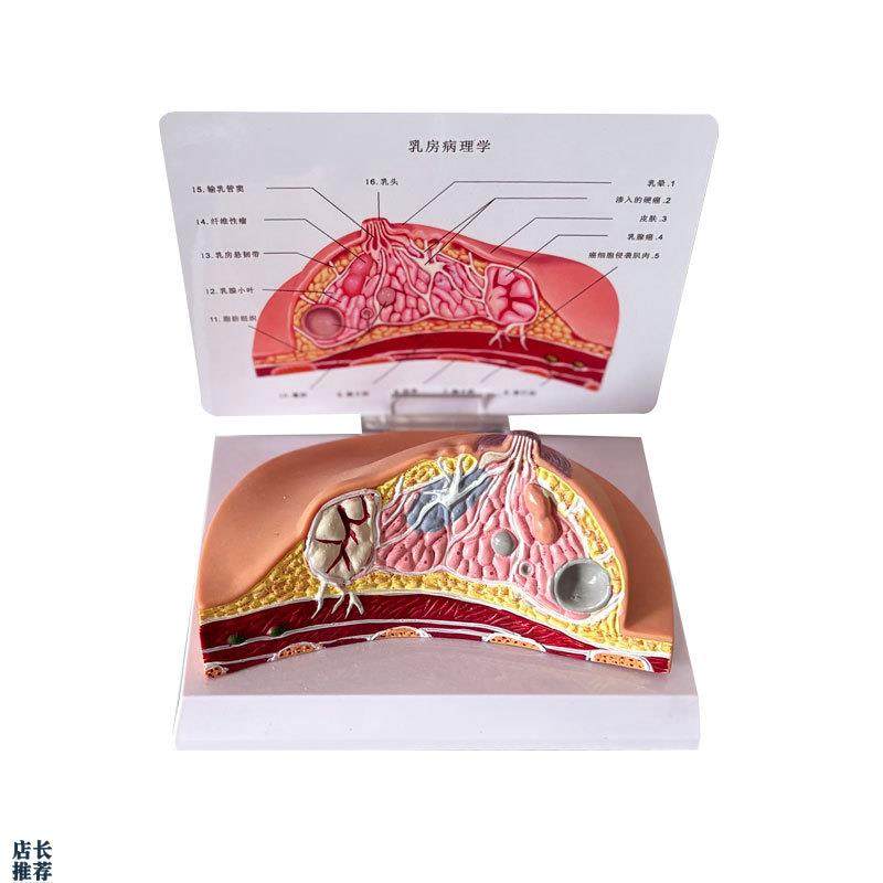 乳房模型乳腺增h生家政培训妇产乳腺演示哺乳期乳房构造催乳师教
