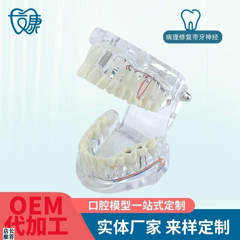 牙齿模型病理修复可拆卸正畸口D腔病理牙模型牙科医患活动沟通