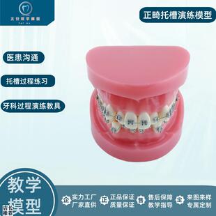 正畸错位牙齿模型牙齿矫正模型厂家E直供口腔教学模型牙齿托槽矫