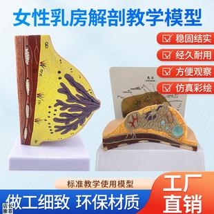 乳房模型乳腺解剖医用教t学模型乳房常见疾病病理解剖结构模型