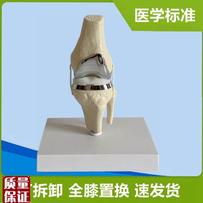 膝关节置换人h工假肢替换半月板胫骨软骨膝盖手术演示临床骨科教