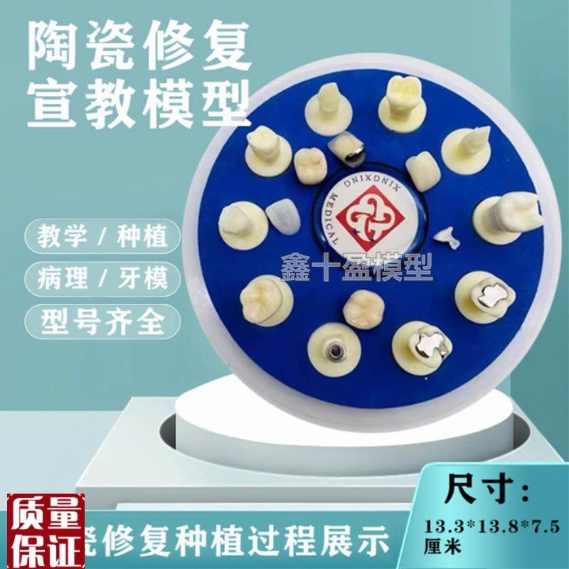 牙齿模型口腔教学陶l瓷10*1仿真修复治疗过程种植根管病理医患沟