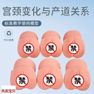 产前宫颈变化与产道关r系模型分娩生产宫颈口变化模具宫颈变化