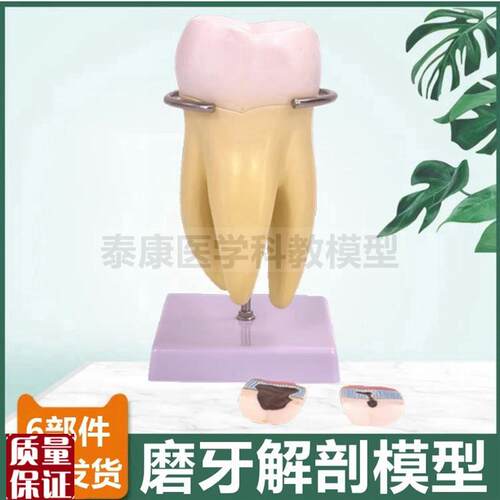 牙齿模型切牙尖牙m磨牙拆卸口腔牙医牙科教学标本龋齿蛀牙发展过