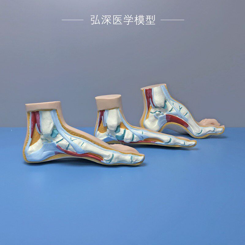 正常足扁平足弓型足模型脚解x剖人体脚部构结构造肌肉血管医学模