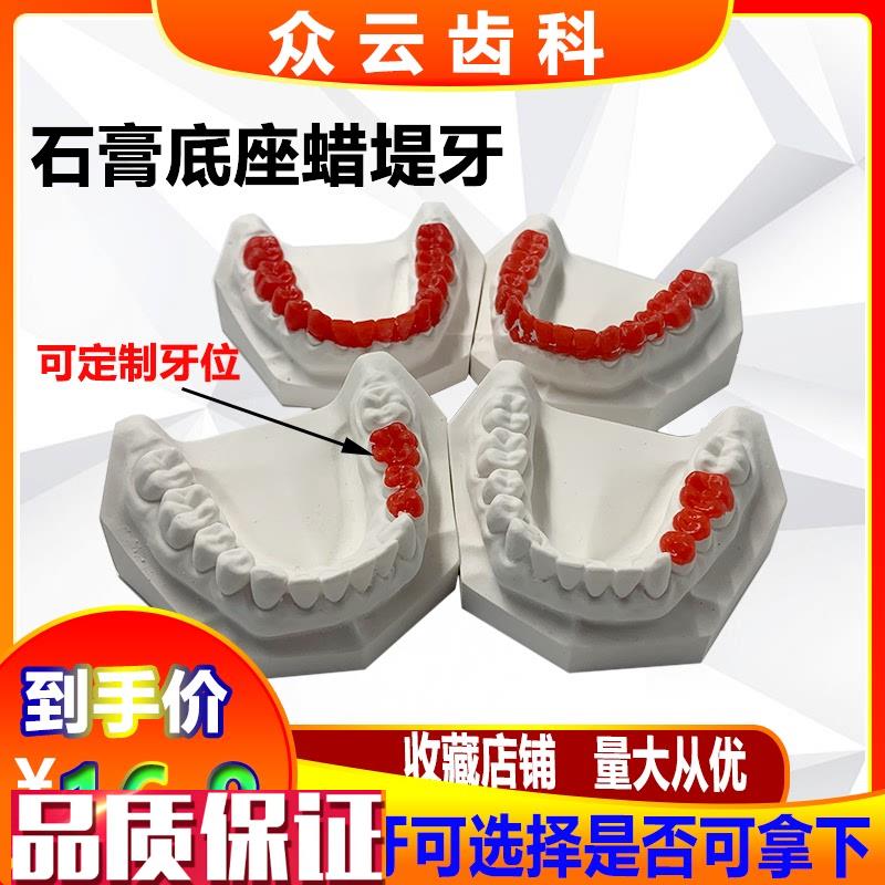 牙科石膏底座蜡堤练习学习基托蜡堤F牙石膏底座模型蜡堤牙位可定