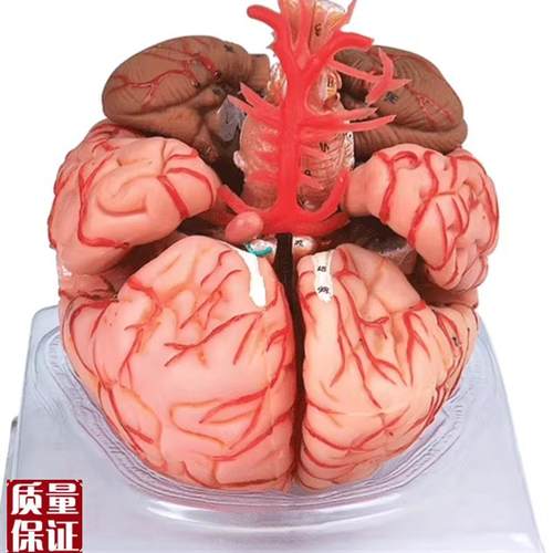 脑动脉模d型GD/A1822